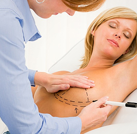 plastyka piersi z użyciem implantów w klinice dr Olender